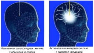 Шишковидная железа